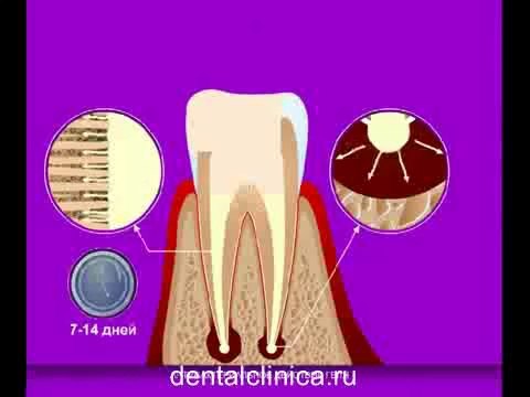 European Clinic of Aesthetic Dentistry Стоматология лечение зубов имплантация европейское качество низкие цены протезирование туризм путешествия отдых