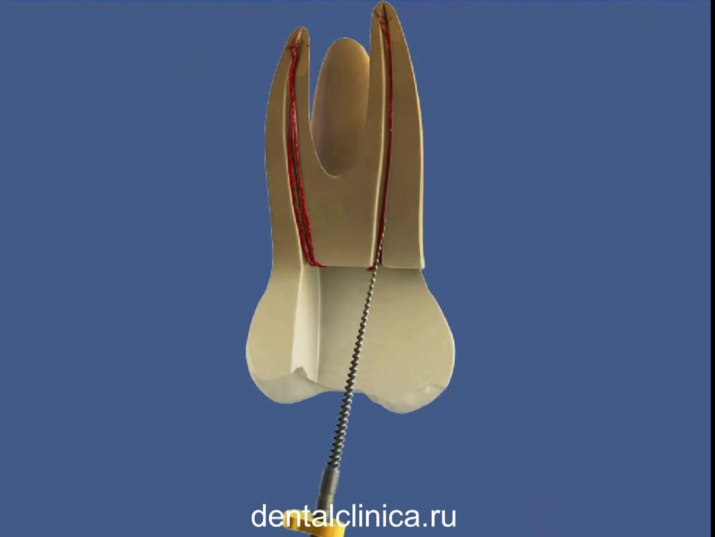European Clinic of Aesthetic Dentistry Стоматология лечение зубов имплантация европейское качество н