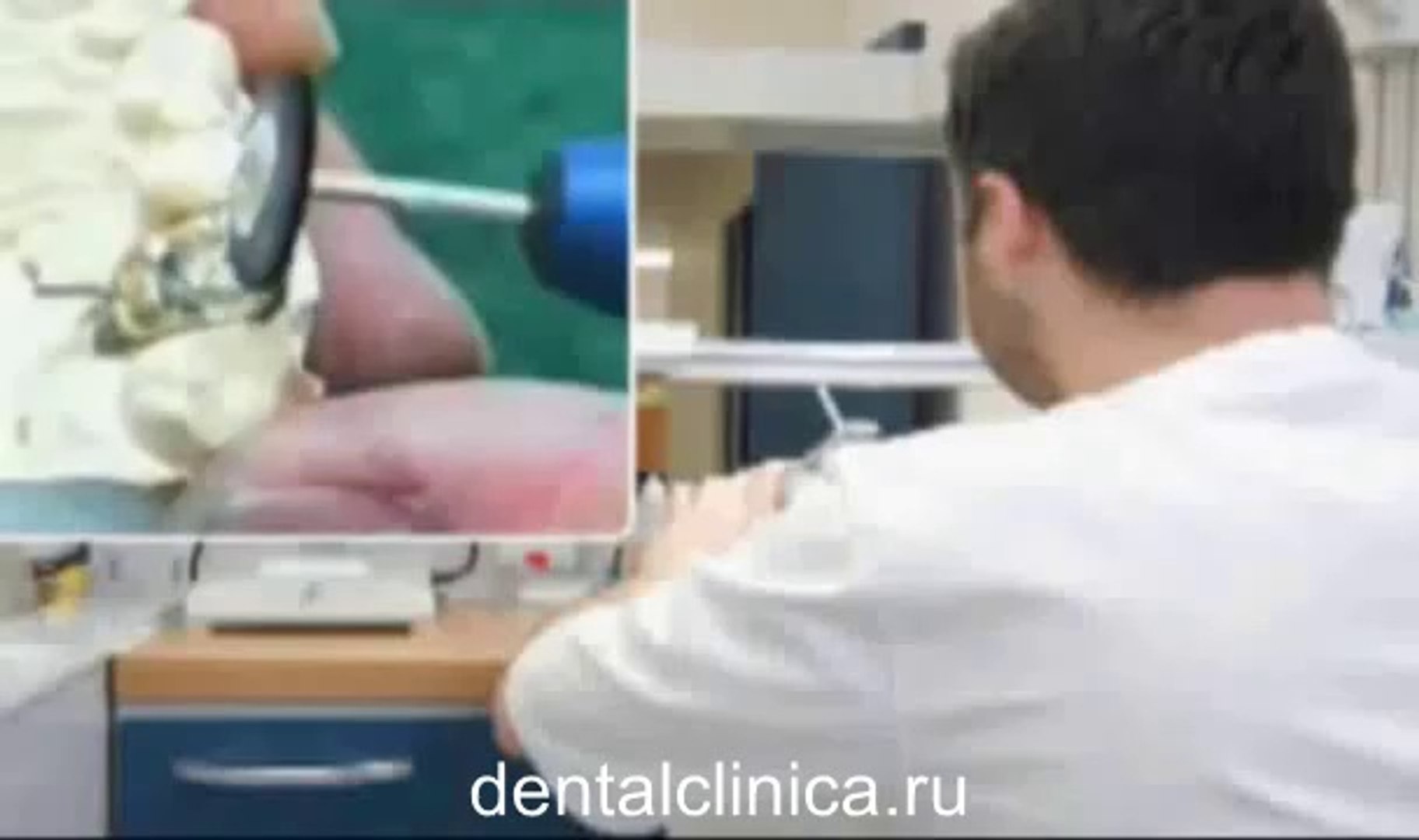 European Clinic of Aesthetic Dentistry in Budapest Стоматология лечение зубов имплантация европейско