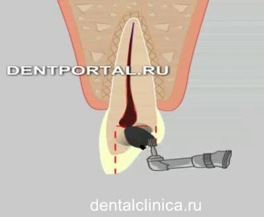 Стоматология лечение зубов в European Clinic of Aesthetic Dentistry in Budapest имплантация европейское качество низкие цены протезирование туризм