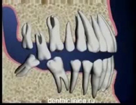 European Clinic of Aesthetic Dentistry in Budapest “Jewel Dental” “AVANTE” dental treatment implantation of prosthesis innovative technology of plastic surgery good rates beautiful smile