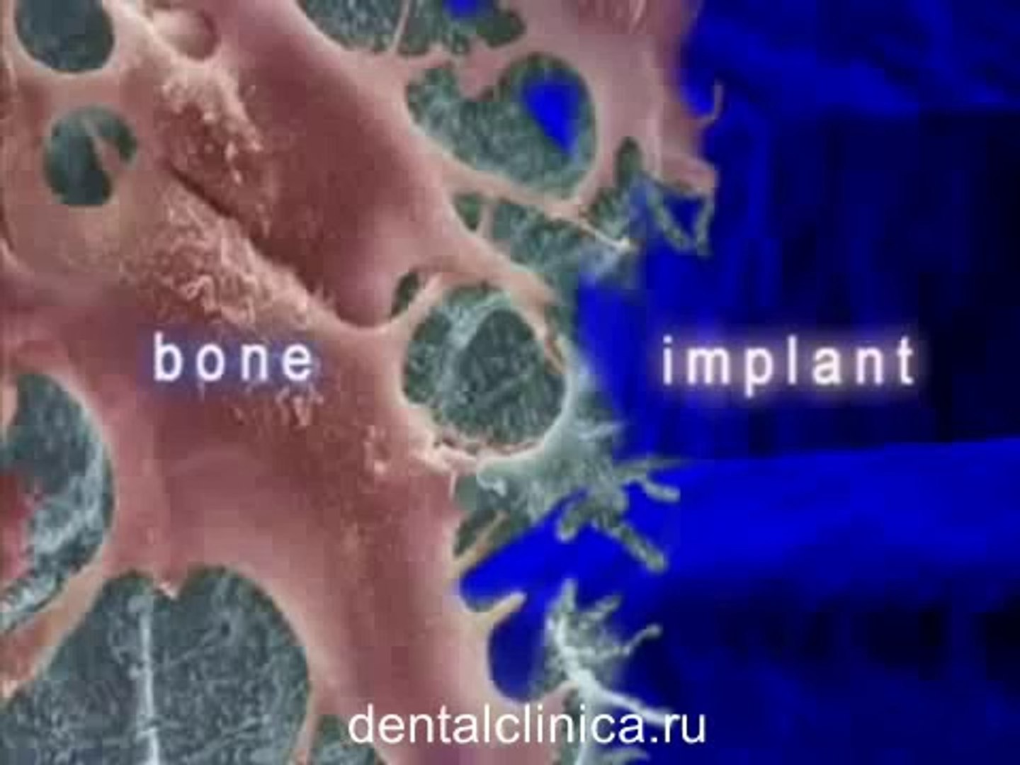 ⁣European Clinic of Aesthetic Dentistry in Budapest “Jewel Dental” “AVANTE” Dentist Medical Center Ст