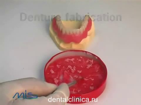 European Clinic of Aesthetic Dentistry in Budapest “Jewel Dental” “AVANTE” Dentist Medical Center Стоматология лечение зубов в Санкт-Петербурге Москве имплантация европейское качество низкие цены протезирование туризм путешествия отдых