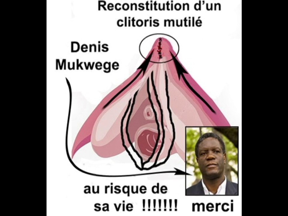 L'excision et le reconstitution en image, dédié au Dr Mukwebe