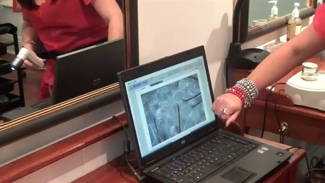 Hair Loss Treatments By Absolique Hair Health Clinic