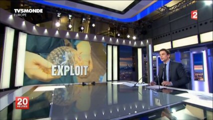 Un crâne imprimé en 3D placée sur une patiente