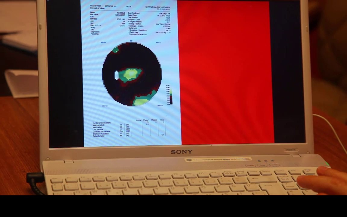 Retinitis Pigmentosa Treatment / Behandlung- FIRATLI CLINIC Proof( Visual Field Test) Eng subtitle!