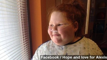 12-Year-Old Girl Recovering Quickly From Weight-Loss Surgery