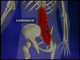 Areas of Inflammation in Ankylosing Spondylitis - YouTube