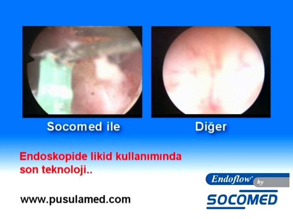 Socomed