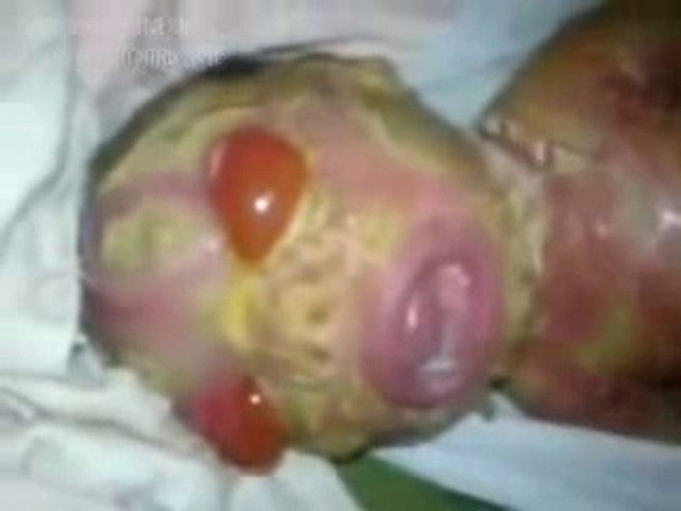 Un beliveable baby born in pakistan