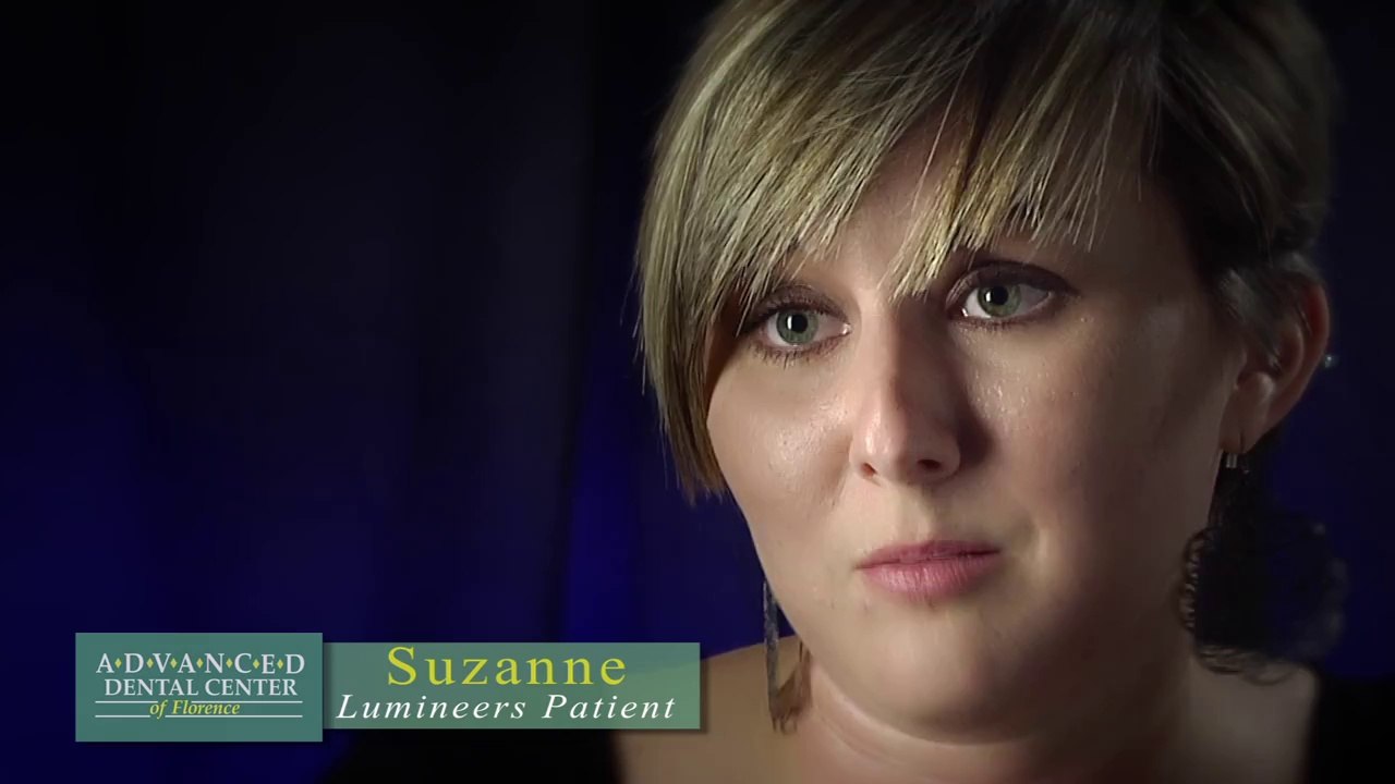 Porcelain Veneers - Florence - Patient Testimonials