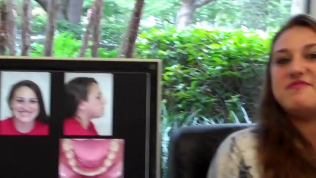 Orthodontist in Plantation Florida - Ariel Patient Testimonial