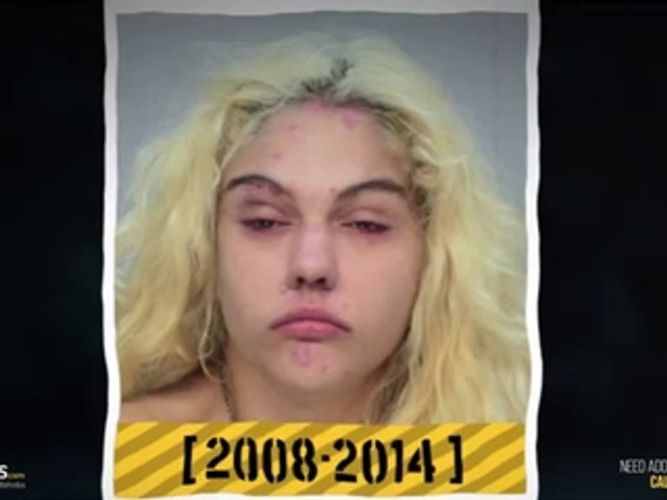 Πριν και μετά :Τα πρόσωπα των τοξικομανών Before and after: The faces of drug addicts