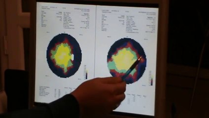 Rétinite Pigmentaire Traitement (Preuve) - French