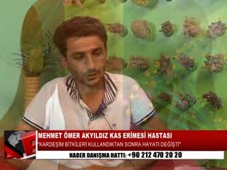 KAS ERİMESİ HASTASIYDI