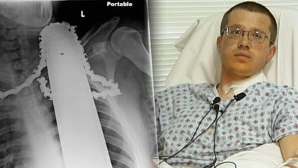 Man Survives Chainsaw in Neck