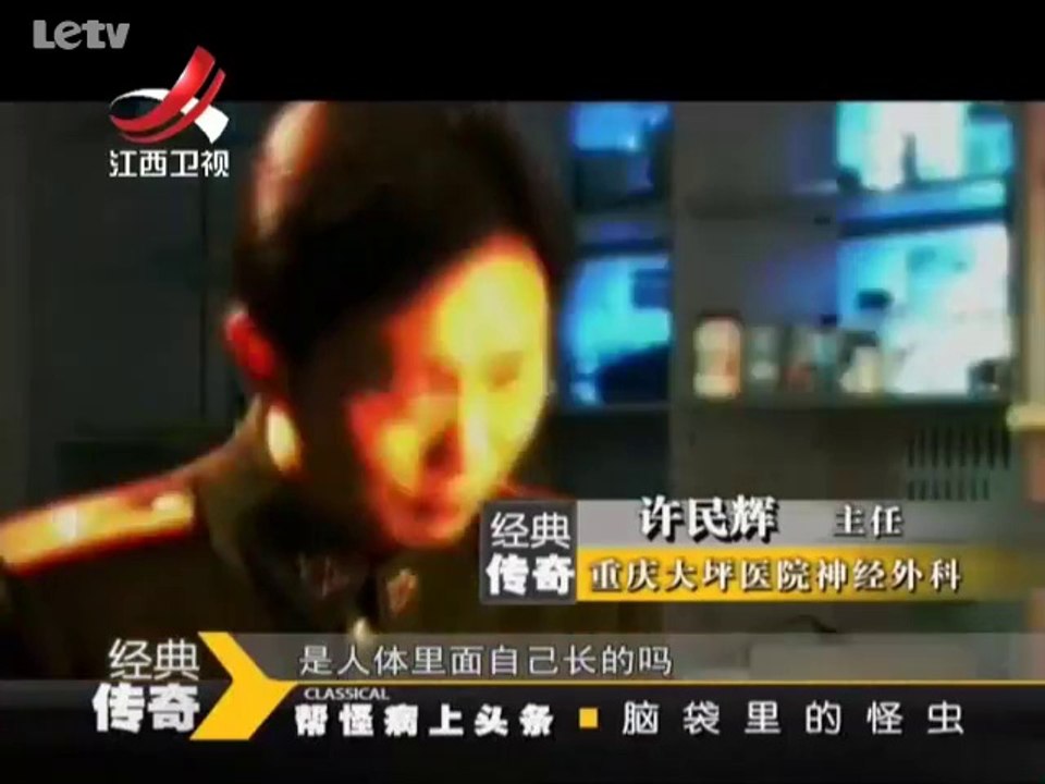20140110  脑袋里的怪虫 帮怪病上头条
