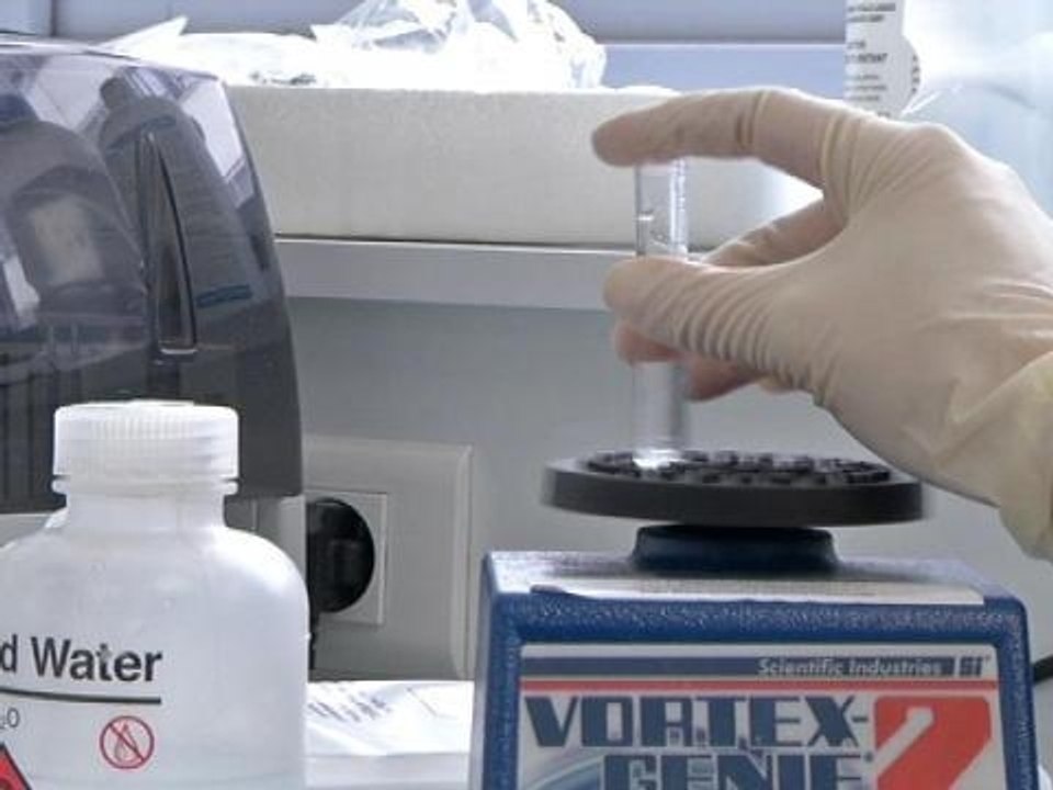 Sida: un vaccin préventif anti-VIH à l’étude en France - 04/04