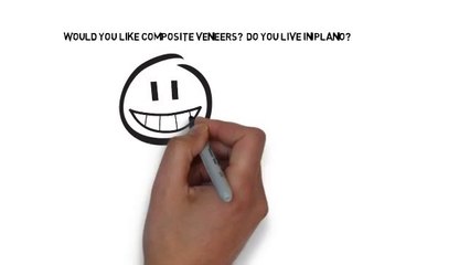 Composite Veneers Plano TX - (972) 432-7808