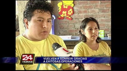 Niños con labio leporino vuelven a sonreír tras ser operados con éxito