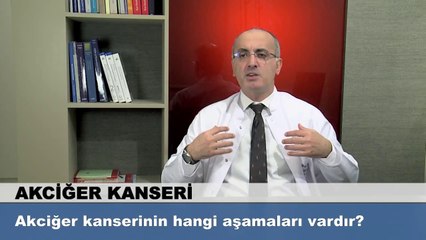Akciğer kanserinin hangi aşamaları vardır?