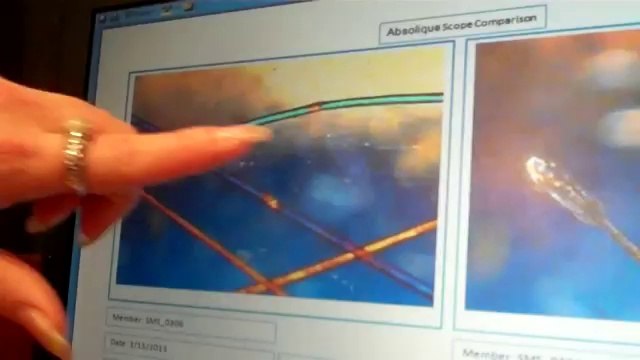 Hair Loss Treatments By Absolique Hair Health Clinic