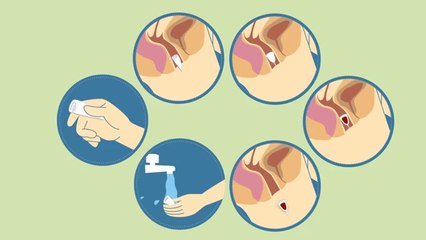 Why use Menstrual Cup By Fairycups