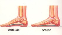 Saginaw, Bay City and Essexville, MI - Children’s Foot Care - Podiatrist Andrew Cohen