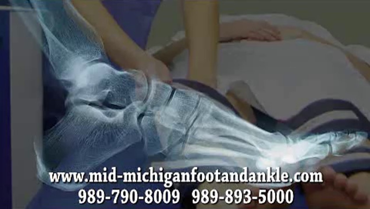 Saginaw, Bay City and Essexville, MI - Diabetic Wound Care - Andrew Cohen, Podiatrist