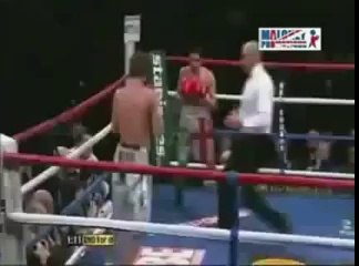 Aptal Tüy Siklet - Takozovic