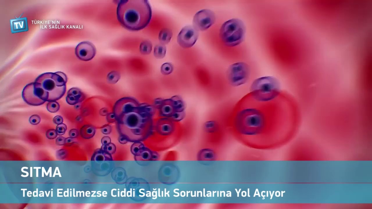 Sıtma
