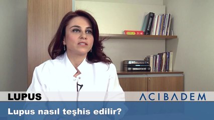 Lupus nasıl teşhis edilir ?