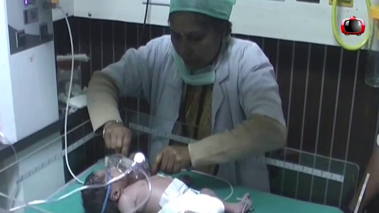 Miracle_two-headed_baby_born_in_India