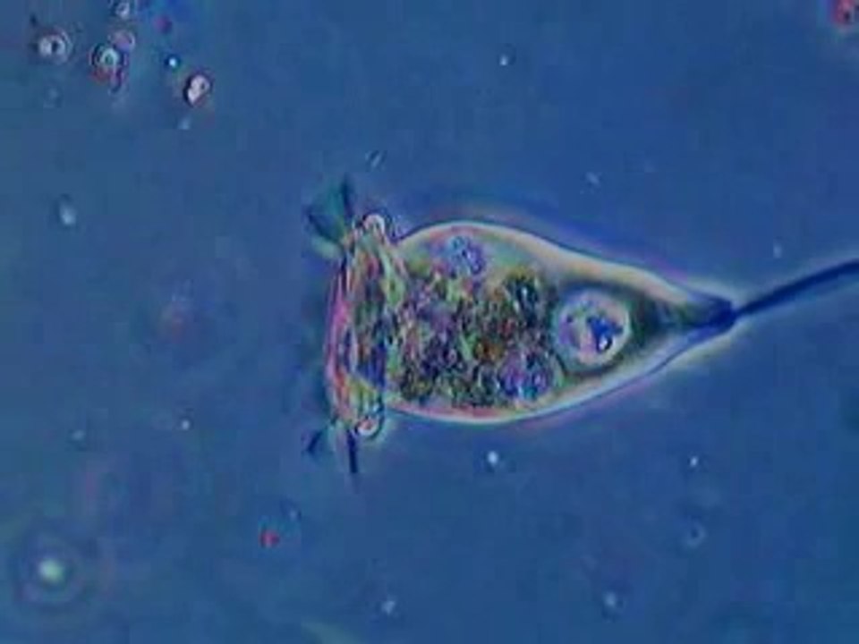 Vorticella comiendo