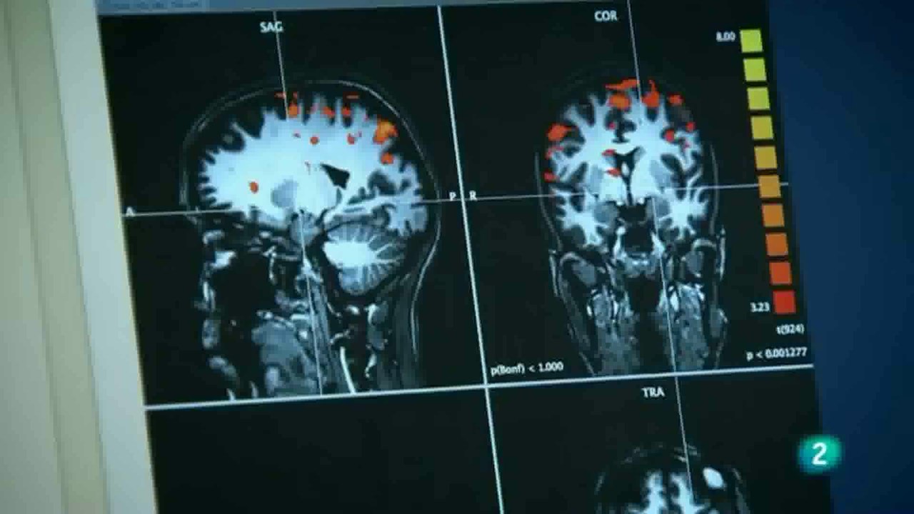 Cerebro hambriento (RMf): Variedad de alimentos