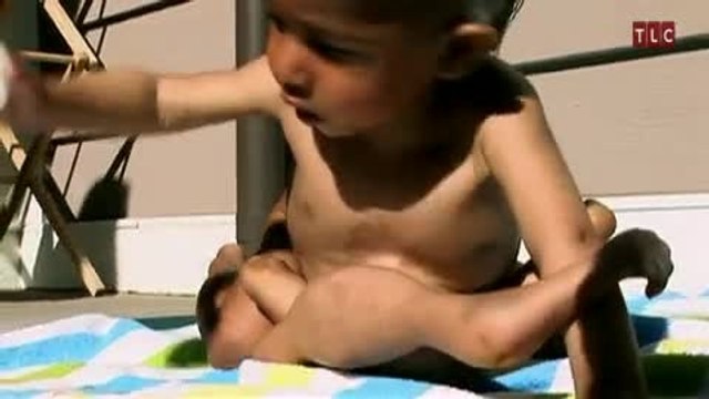 Un bébé avec 8 membres en Inde