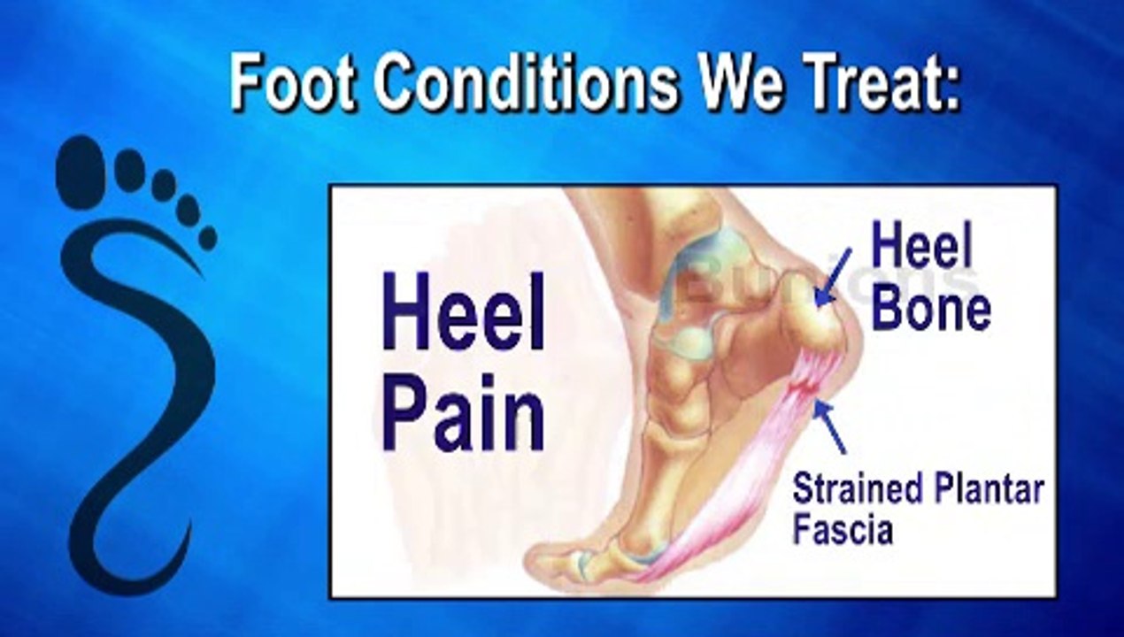 Parma, Rocky River, Independence, Ohio - Podiatrist Joseph Ripepi, DPM - Foot & Ankle Clinics