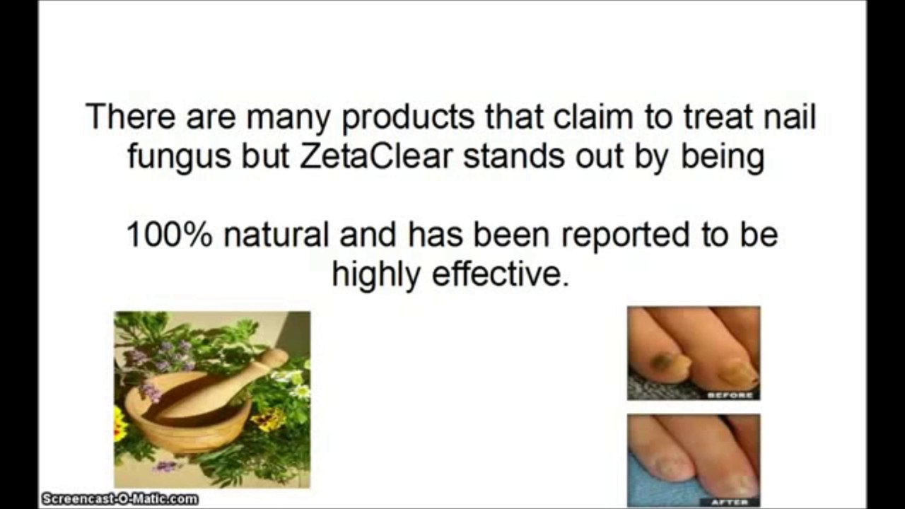 Zetaclear
