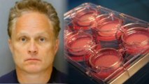 Man Allegedly Stole $350k of Human Skin from Hospital
