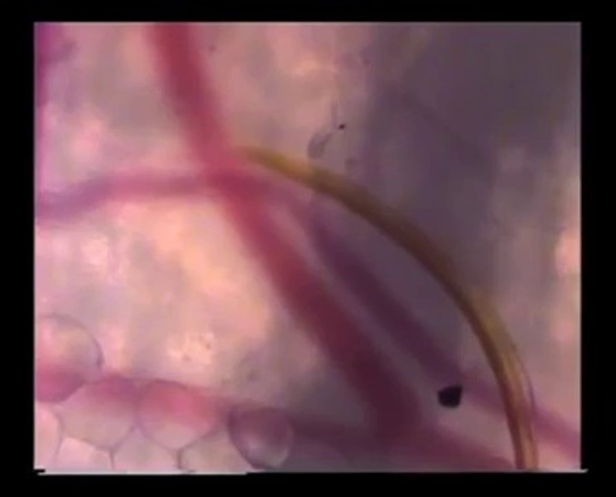 Quand un moustique vous pique, voilà ce que ça donne sous votre peau!