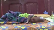 Bangui: plusieurs cas grave de malnutritions infantile