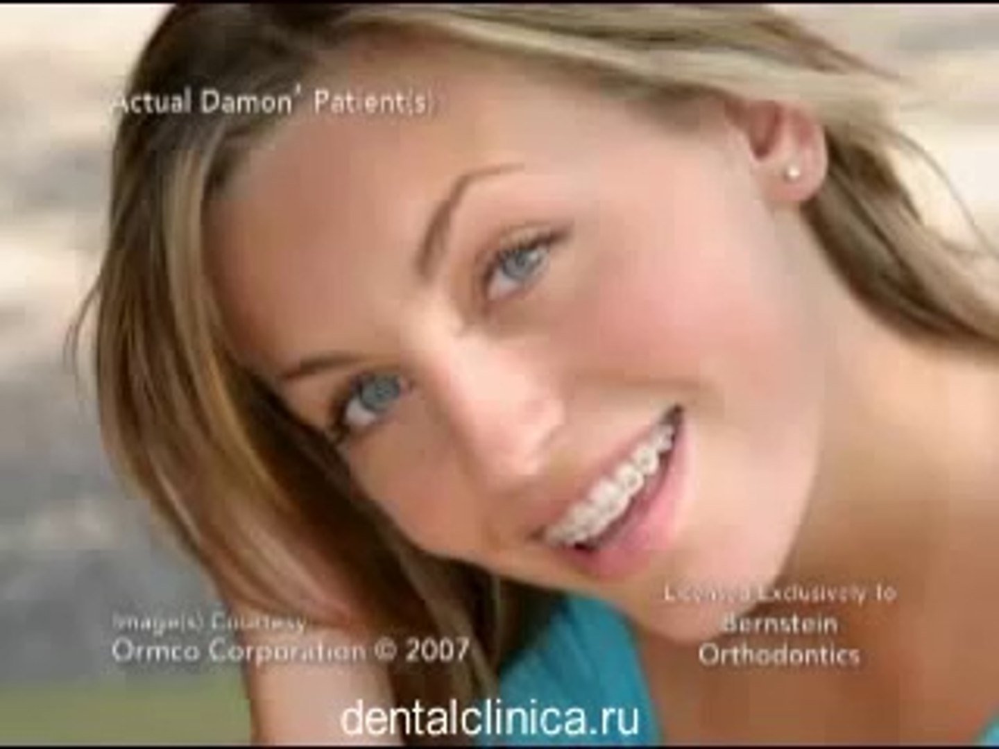 ⁣Лечение зубов European Clinic of Aesthetic Dentistry The Damon System