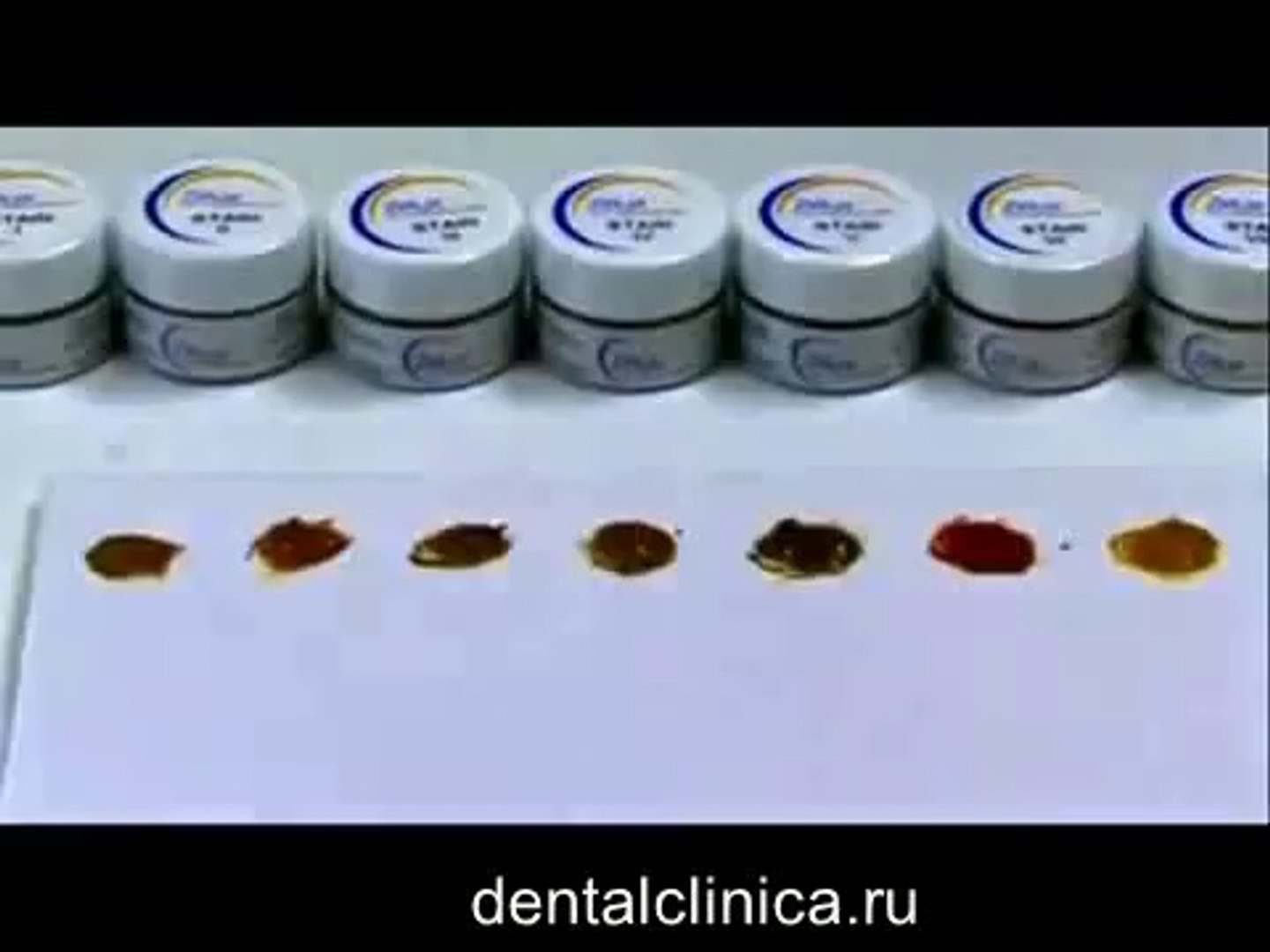 ⁣Лечение зубов протезирование коронки керамика, hi-tech зуботехническая лаборатория