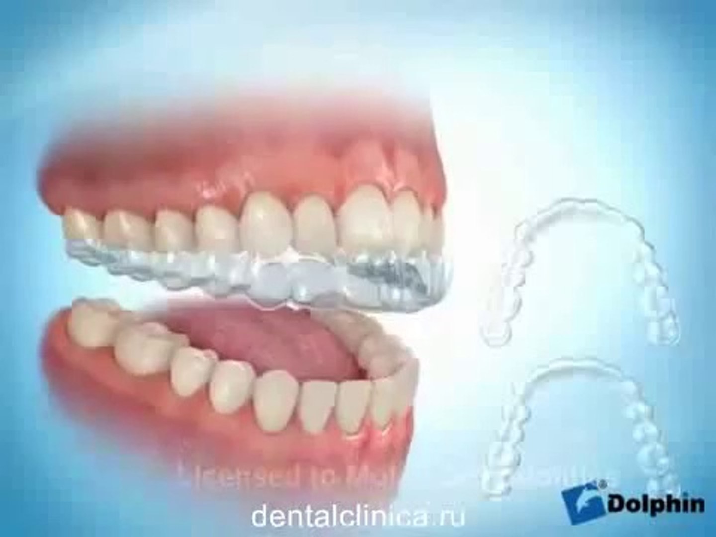 ⁣Лечение зубов эстетическая стоматология Красивая улыбка прекрасное настроение
