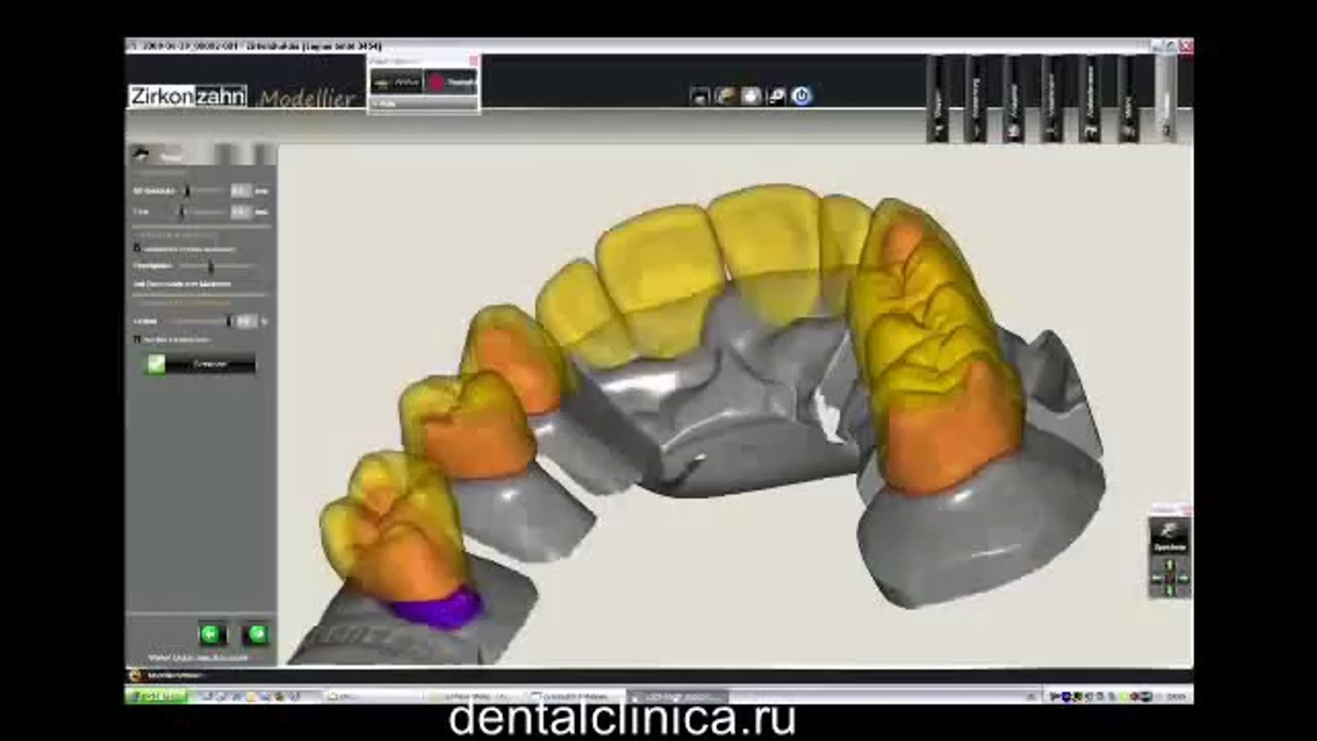 ⁣Лечение зубов, CAD моделирование, 3D принтер, протезирование на имплантах European Clinic of Aesthet