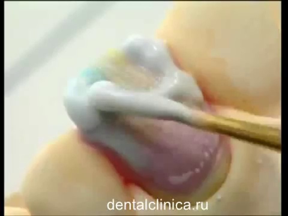 Клиника Имплантологии и Эстетической Стоматологии Презентация Hi-Tech Carat Keramik German Эстетическая стоматология протезирование