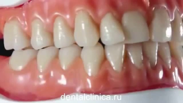 Международная клиника имплантологии и протезирования Протезирование art hi-tech стоматология улыбки на лицах European Clinic of Aesthetic Dentistry