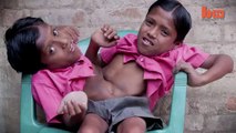 The Indian conjoined twins who are worshipped as a divine incarnation and say they NEVER want to be separated