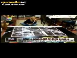 Selçuk İnan’ı Tavlayabilmek İçin Bacaklarına Estetik Yaptıran Kadın